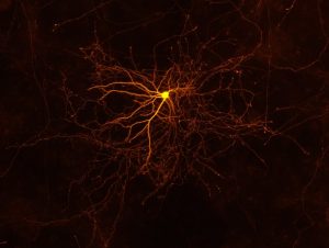 Neuron photo