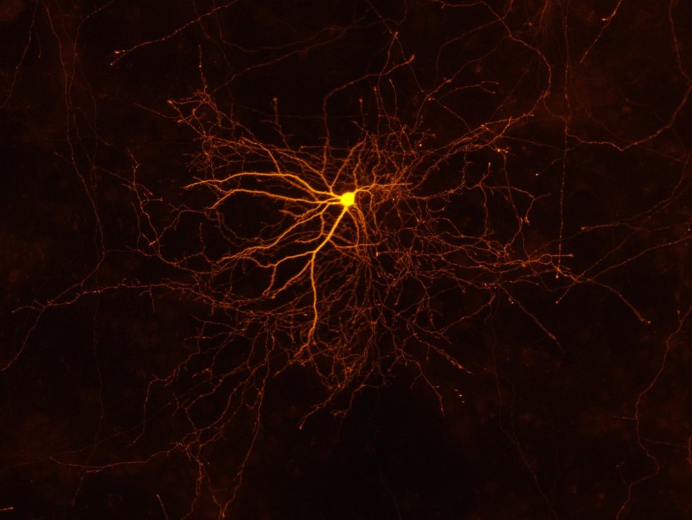 Neuron photo